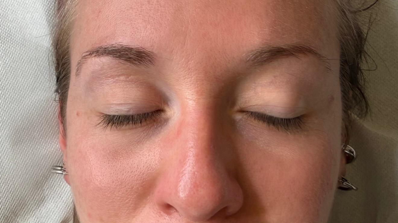 Prima del trattamento